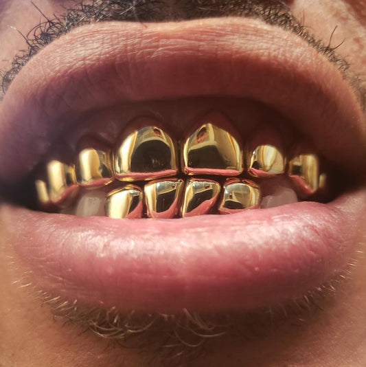 18 Karat Gold Grillz