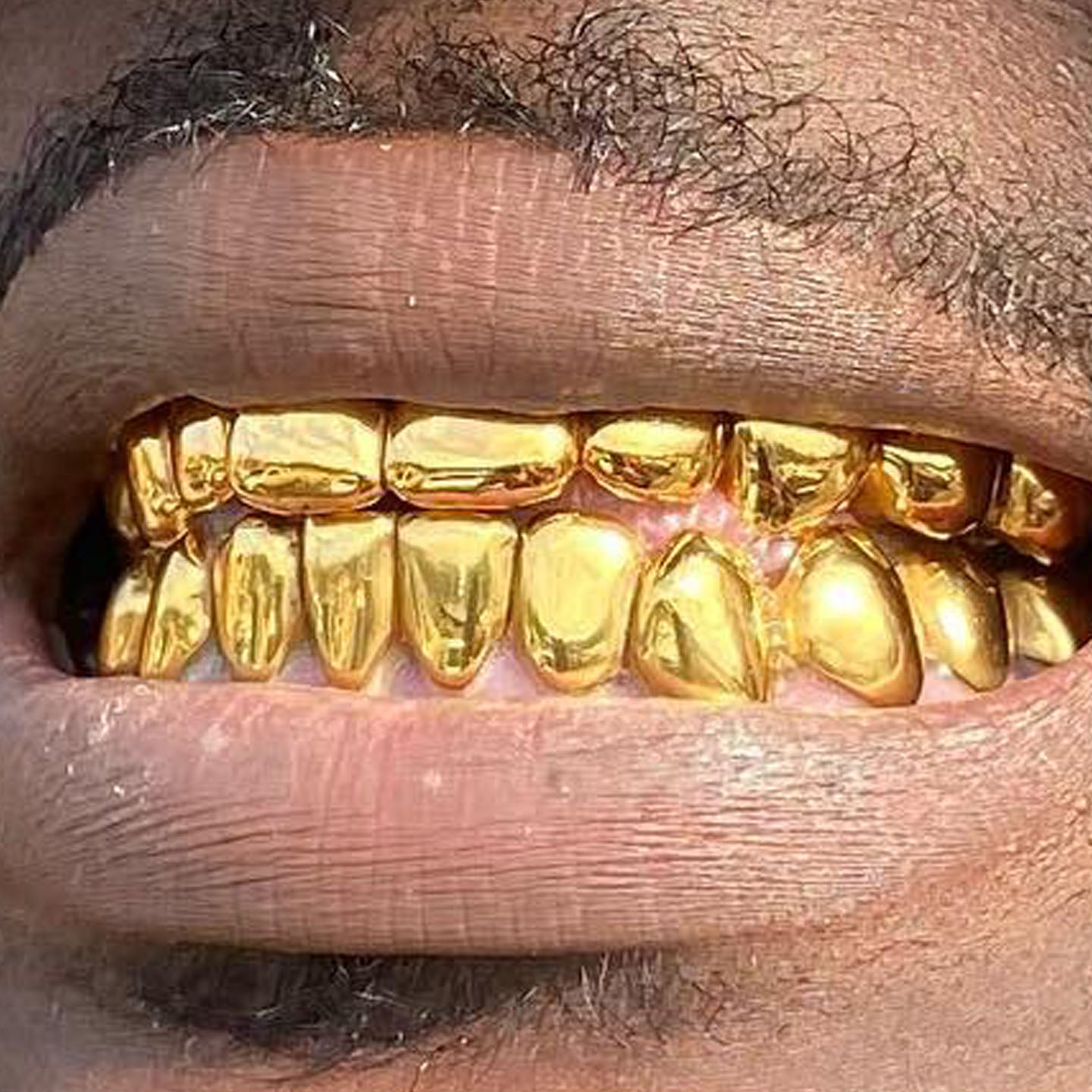 NPG Dental gold  Set SPECIALS (plated in 24k)