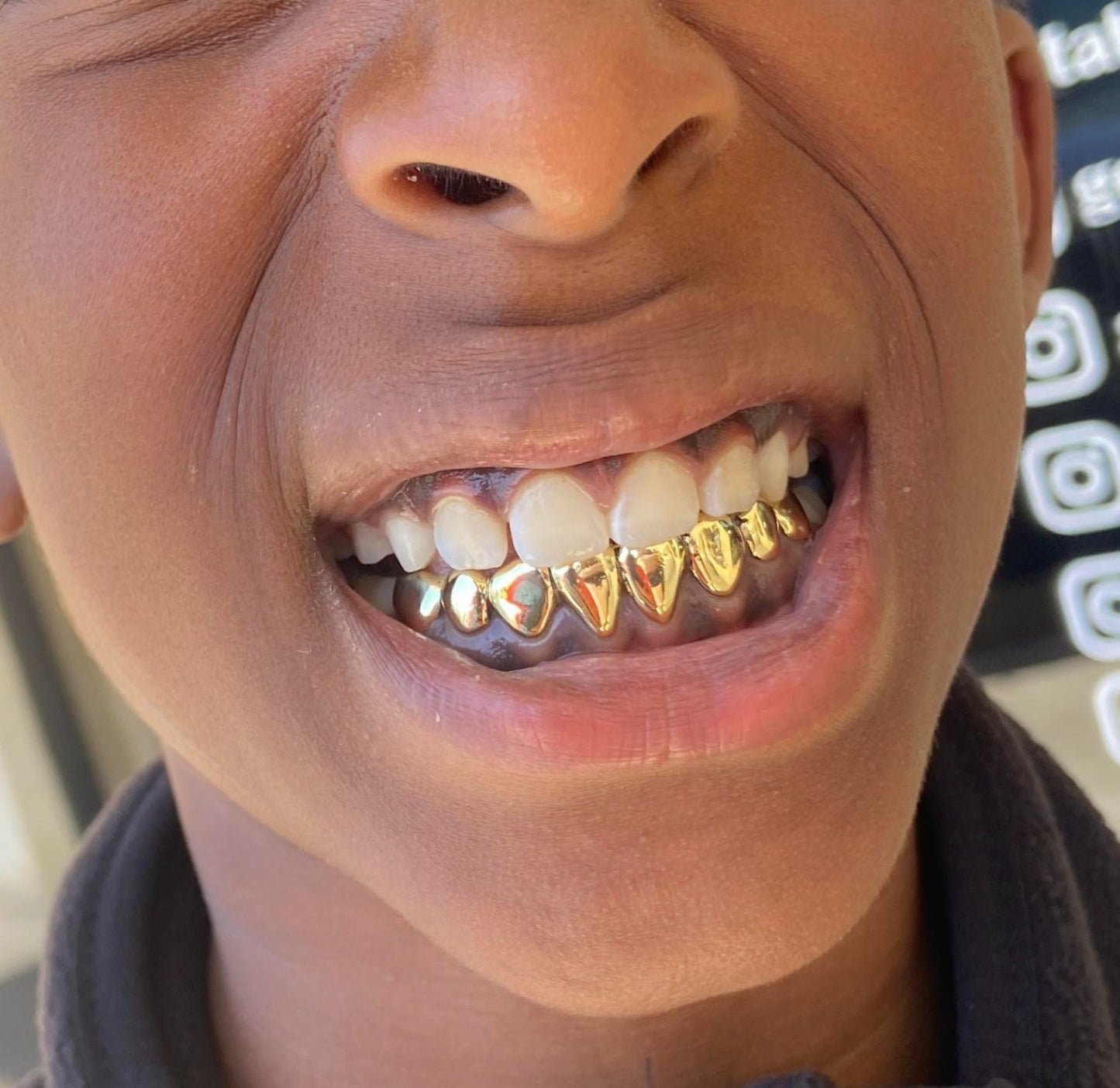 Silver or NPG grillz